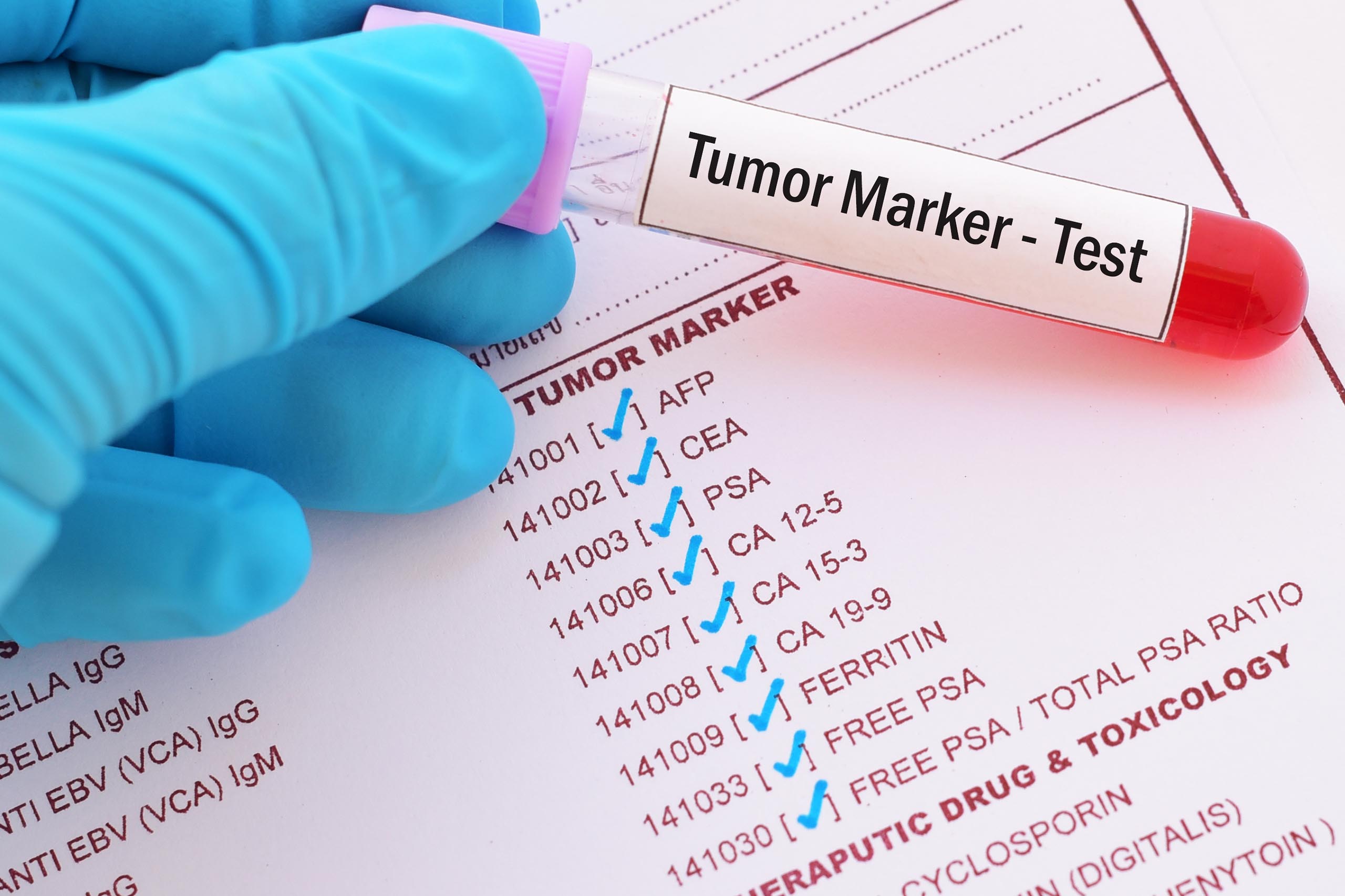 Cancer Biomaker Tumor Marker